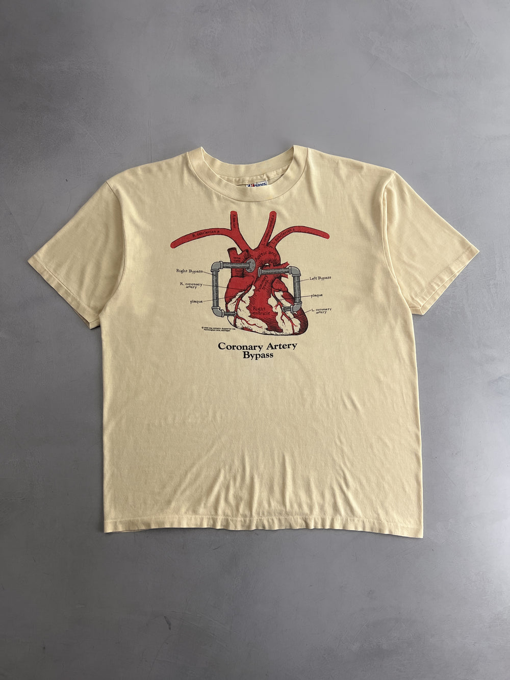 1980's Coronary Artery Bypass Tee [XL]