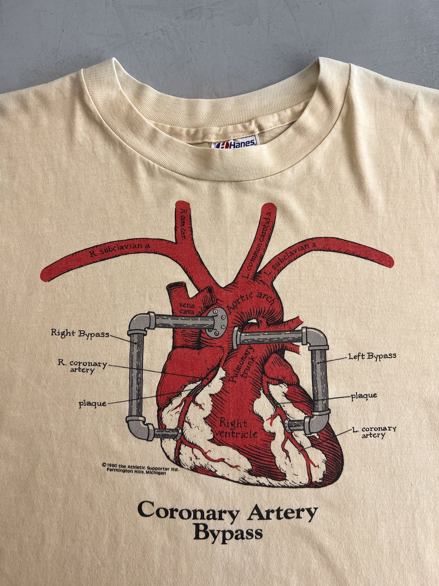 1980's Coronary Artery Bypass Tee [XL]